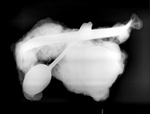 X-ray of artifact 14S 420.1